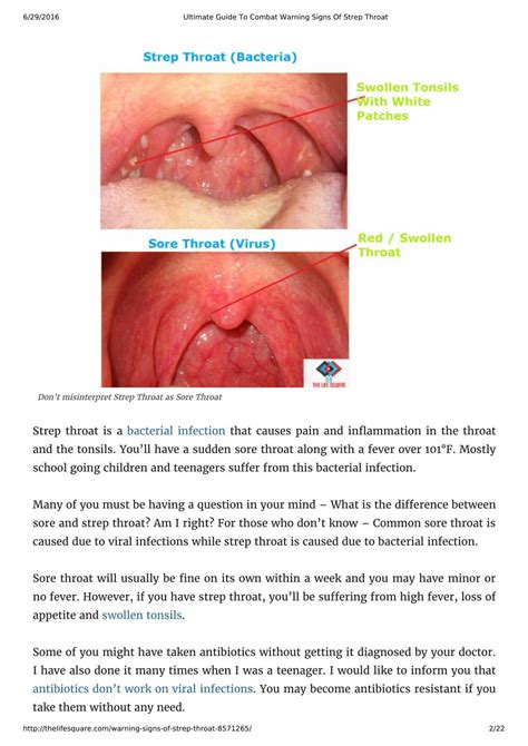 Strep Throat Conclusion
