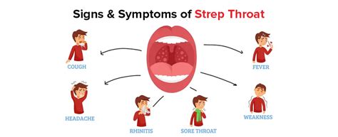 strep throat symptoms management