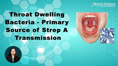Strep Throat Transmission