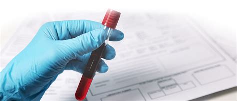 stress-free blood test