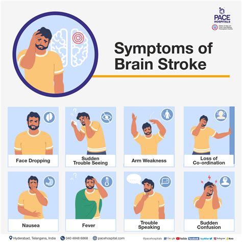 Symptoms of Stroke