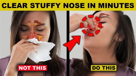 stuffy nose causes