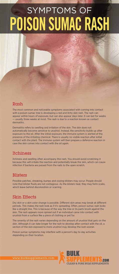 sumac causes rash