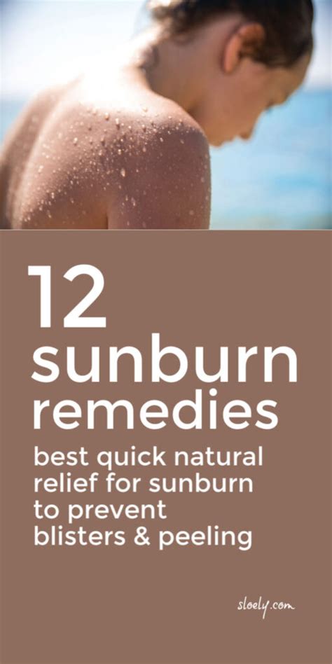 Calamine lotion for sunburn relief