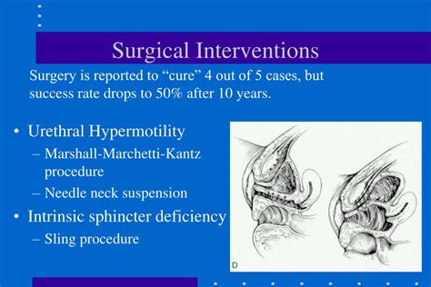 Surgical Interventions for Urge Incontinence