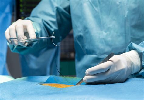 surgical options