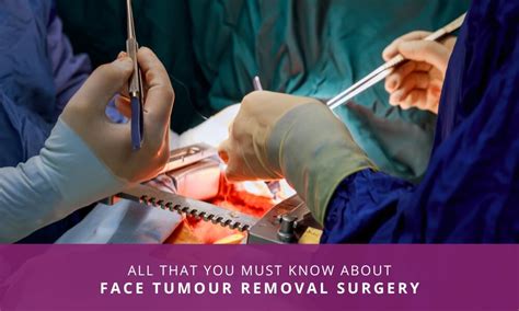 surgical removal