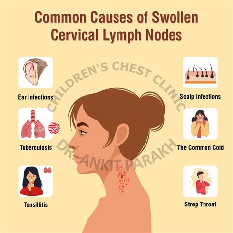 swollen lymph nodes