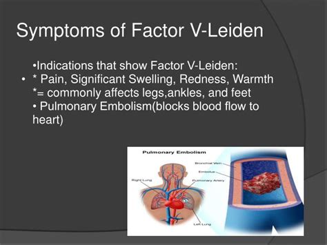 Symptoms of Factor 5 Leiden Syndrome