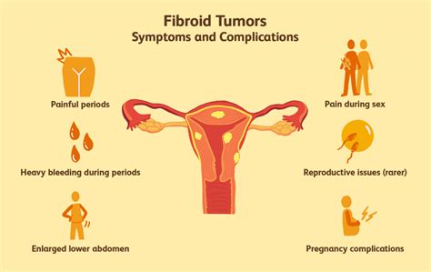 Symptoms of Fibroids