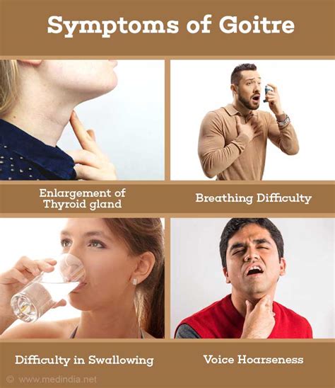 Symptoms of Goiter Disease