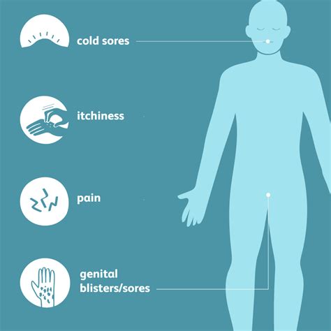 Symptoms of herpes on hands