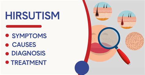 Symptoms of Hirsutism