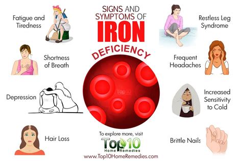 symptoms of iron deficiency
