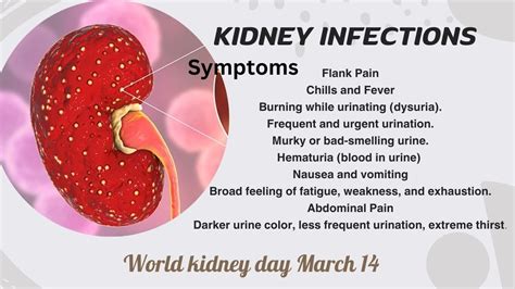 Symptoms of Kidney Infections Image