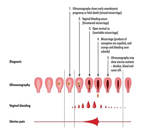 symptoms of light spotting during pregnancy