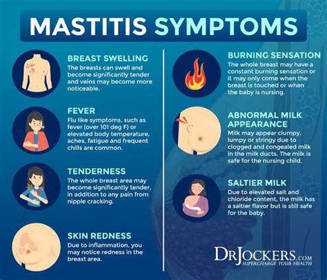 Symptoms of Mastitis Image