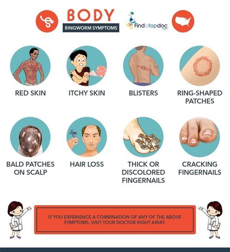 Symptoms of Ringworm