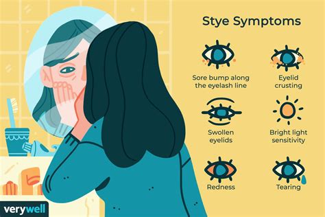 Symptoms of Styes