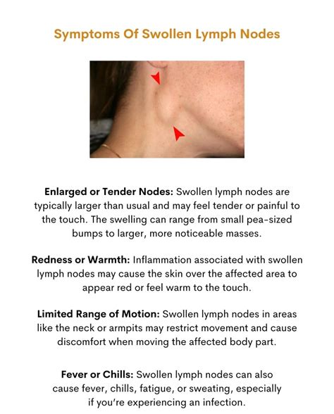 Symptoms of Tender Lymph Nodes