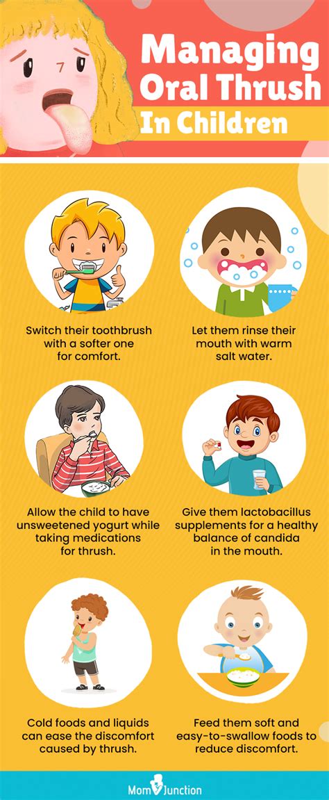 Symptoms of thrush in babies