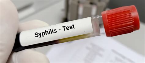 Syphilis testing methods