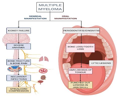 systemic diseases