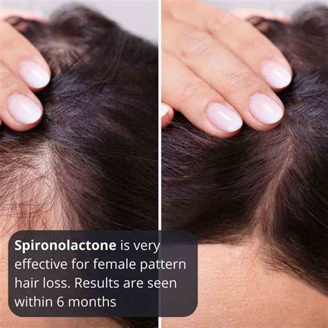 Steps for taking spironolactone