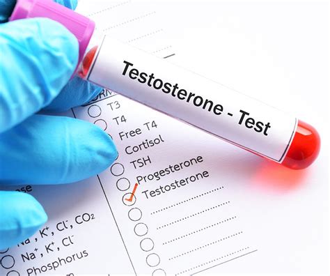 Testosterone Blood Test