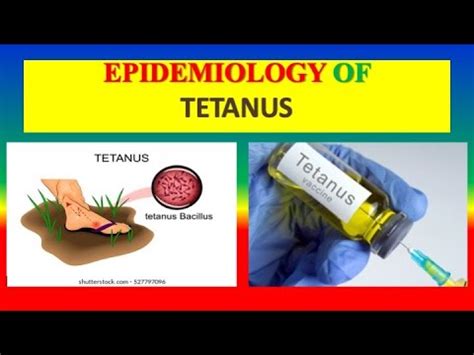 Advancements in Tetanus Research