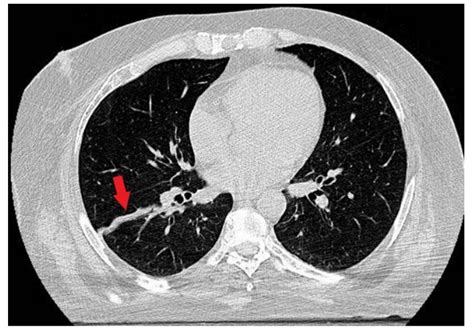 Thoracic CT Scan Centers
