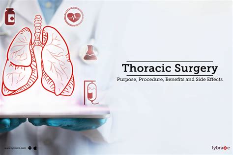 thoracic surgeon benefits