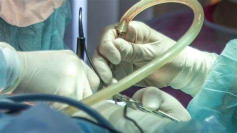thoracic surgeon employer