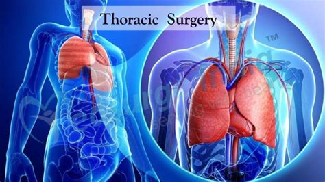 thoracic surgeon outlook