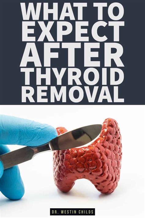 Recovery from thyroidectomy