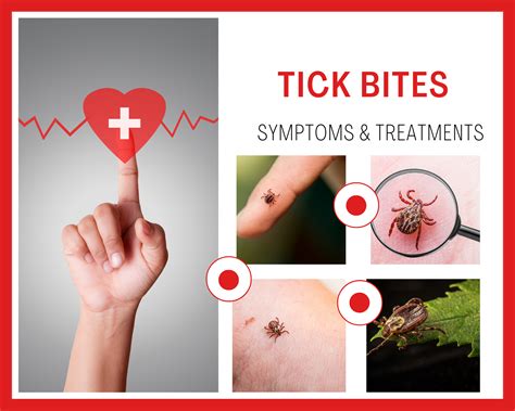 Tick Bite Rash Prevention
