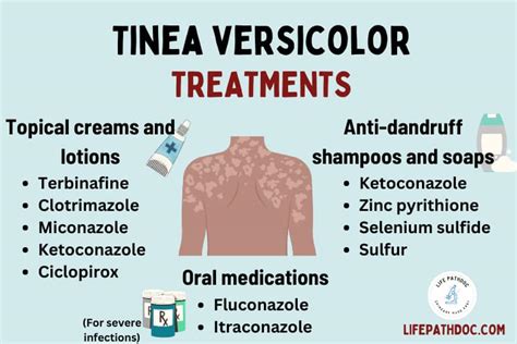 tinea versicolor prevention