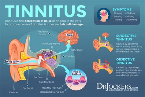 Tinnitus Symptoms