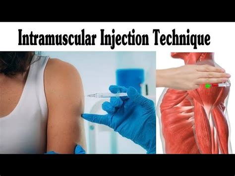 Tips for Administering Intramuscular Injections