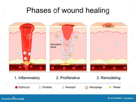 tissue repair
