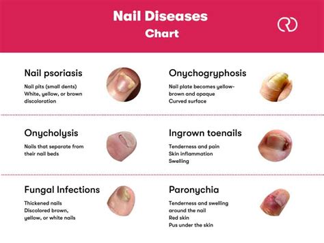 Toenail Care for Different Conditions