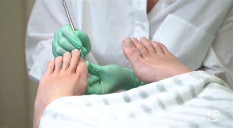 toenail detachment complications