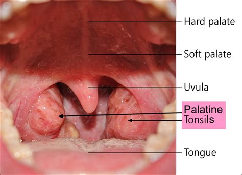 tonsil health