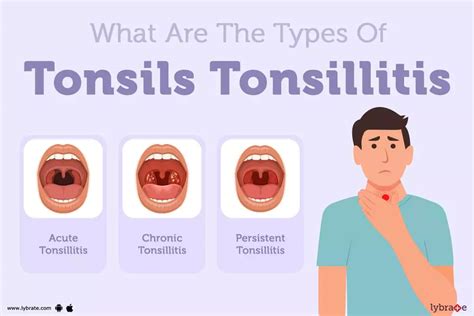tonsil problems