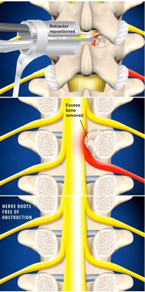 Top Spinal Centers
