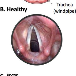 tracheal health nutrition
