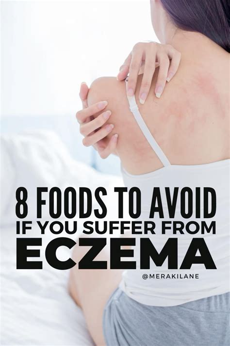 treating eczema and itching