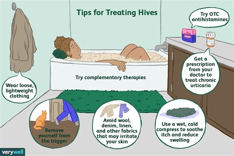 treating hives and redness