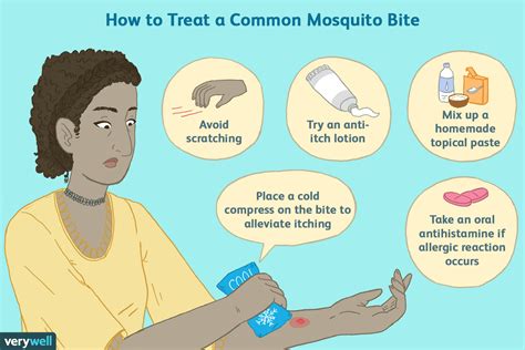 treating mosquito bites