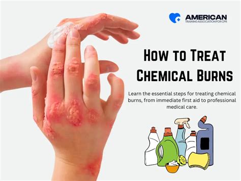 treatment for chemical burns